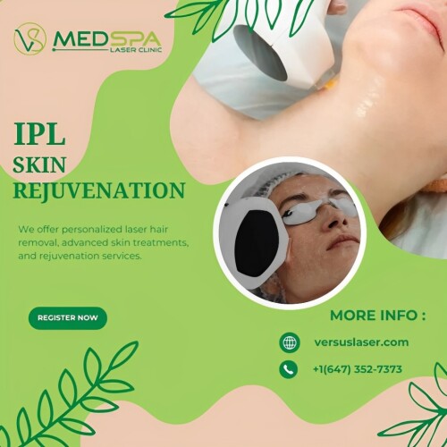 Dull skin, sun damage, or redness? VS MedSpa Laser Clinic provides IPL skin rejuvenation, a powerful treatment that targets pigmentation, fine lines, and uneven skin tone. This non-invasive laser treatment stimulates collagen production, leaving your skin refreshed and youthful.

Visit Us: https://www.versuslaser.com/treatment/photofacial-ipl-rejuvenation/

Google Map: https://goo.gl/maps/BoMmiw1Brr3Wqvge8