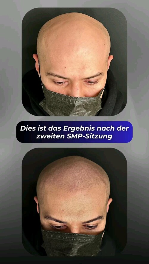 Scvf.jpg