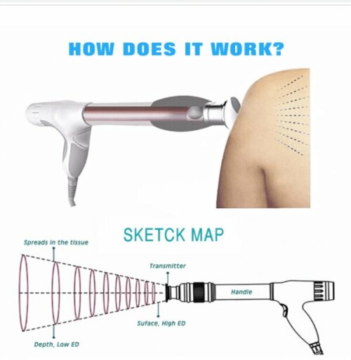 Snpu.jpg