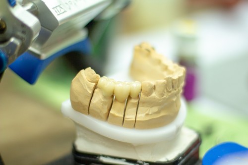 d81f62.jpg