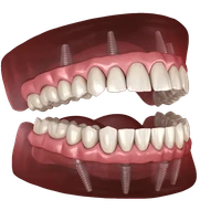 jJC4.png
